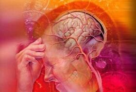 Cervical Migraine syndrome