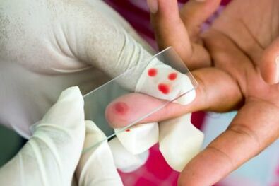 Diagnosis of pain in the joints of fingers