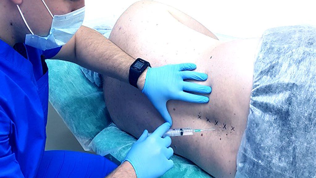 The spinal block for osteocondrosis