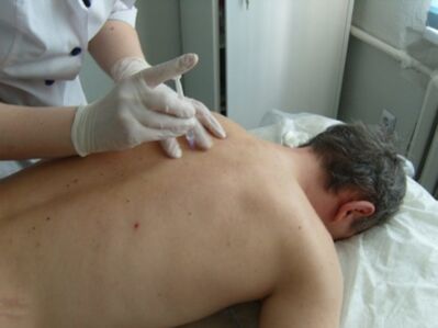 Fine injections of chondroprotectors for thoracic osteochondrosis