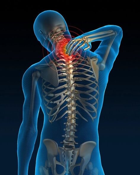 In the initial stage of treatment of cervical osteochondrosis, pain in the neck increases